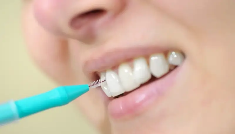 Zabiegi dentystyczne refundowane przez NFZ